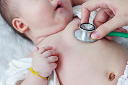 Virus respiratorio sinciziale, buoni risultati da un anticorpo