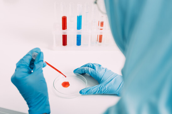 Test del sangue per anticipare la diagnosi di celiachia. Attestazione: LightFieldStudios-iStock